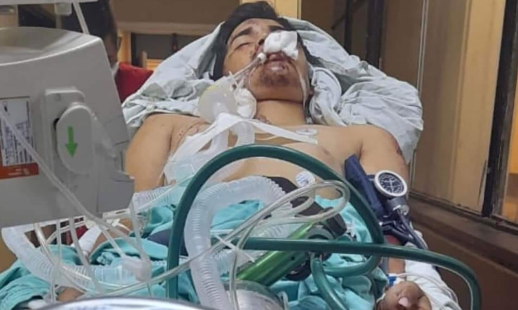 Dilata IMSS cirugía de joven empalmense
