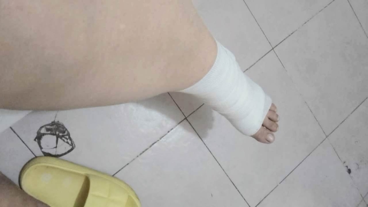 Mujer cae a alcantarilla destapada y se lesiona